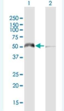 KHDRBS3 Antibody, Novus Biologicals 50 &mu;g | Buy Online | Novus Biologicals | Fisher Scientific