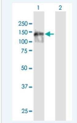 SPIDR Antibody, Novus Biologicals 50 &mu;g | Buy Online | Novus Biologicals | Fisher Scientific
