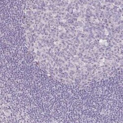 KIAA1210 Antibody, Novus Biologicals 25 &mu;L | Buy Online | Novus Biologicals | Fisher Scientific