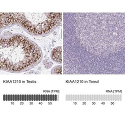 KIAA1210 Antibody, Novus Biologicals 25 &mu;L | Buy Online | Novus Biologicals | Fisher Scientific
