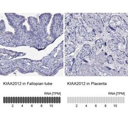 KIAA2012 Rabbit anti-Human, Polyclonal, Novus Biologicals 100 &mu;g; Unconjugated:Antibodies,