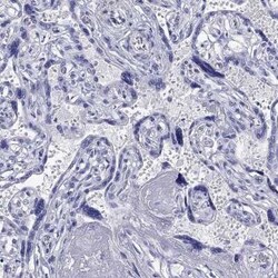 KIAA2012 Rabbit anti-Human, Polyclonal, Novus Biologicals 100 &mu;g; Unconjugated:Antibodies,