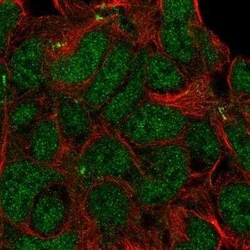 KIDINS220 Antibody, Novus Biologicals 0.1 mL; Unconjugated:Antibodies,