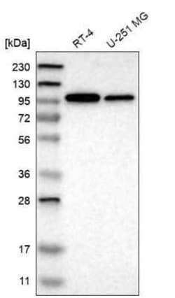 KIDINS220 Antibody, Novus Biologicals 0.1 mL; Unconjugated:Antibodies,