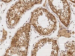 KIF1-binding protein Antibody, Novus Biologicals:Antibodies:Primary Antibodies