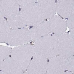 KIF13B Antibody, Novus Biologicals 100 &mu;g; Unconjugated:Antibodies,