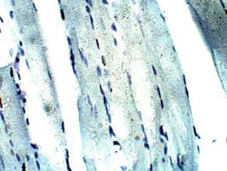KIF14 Antibody, Novus Biologicals 100 &mu;g; Unconjugated:Antibodies, Polyclonal