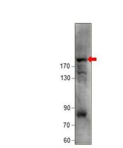 KIF14 Antibody, Novus Biologicals 100 &mu;g; Unconjugated:Antibodies, Polyclonal