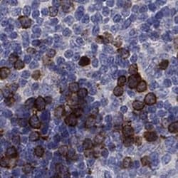 KIF15 Rabbit anti-Human, Polyclonal, Novus Biologicals 25 &mu;g; Unconjugated:Antibodies,
