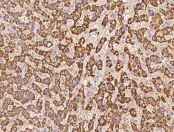KIF22 Antibody, Novus Biologicals:Antibodies:Primary Antibodies