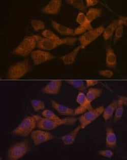 KIF3A Rabbit anti-Human, Mouse, Rat, Clone: 1C8K4, Novus Biologicals 100