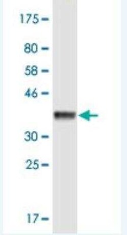 KIF3B Antibody (8H4), Novus Biologicals 100 &mu;g | Buy Online | Novus Biologicals | Fisher Scientific