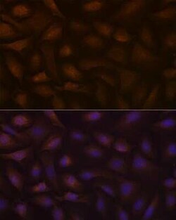 KIFAP3 Rabbit anti-Human, Mouse, Rat, Clone: 1S7J7, Novus Biologicals 100 &mu;g | Buy Online | Novus Biologicals | Fisher Scientific