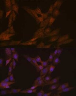 KIFC1 Rabbit anti-Human, Mouse, Clone: 10M10J4, Novus Biologicals 100 &mu;g;