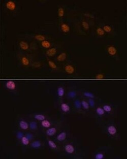 KIFC1 Rabbit anti-Human, Mouse, Clone: 10M10J4, Novus Biologicals 100 &mu;g;