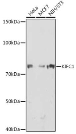 KIFC1 Rabbit anti-Human, Mouse, Clone: 10M10J4, Novus Biologicals 100 &mu;g;