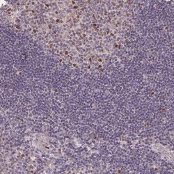 KIFC1 Antibody, Novus Biologicals:Antibodies:Primary Antibodies