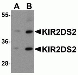KIR2DS2 Antibody - BSA Free, Novus Biologicals 0.1 mg; Unconjugated:Antibodies,