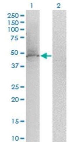 KLF1 Antibody (2A6), Novus Biologicals 0.1 mg | Buy Online | Novus Biologicals | Fisher Scientific