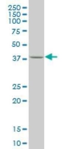 Novus Biologicals KLF1 Antibody (4E10), Novus Biologicals 0.1 mg; Unconjugated:Antibodies,