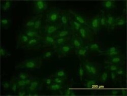 KLF11 Antibody (8F4), Novus Biologicals 0.1 mg | Buy Online | Novus Biologicals | Fisher Scientific