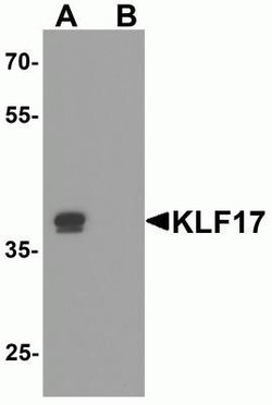 KLF17 Antibody - BSA Free, Novus Biologicals 0.1 mg | Buy Online | Novus Biologicals | Fisher Scientific