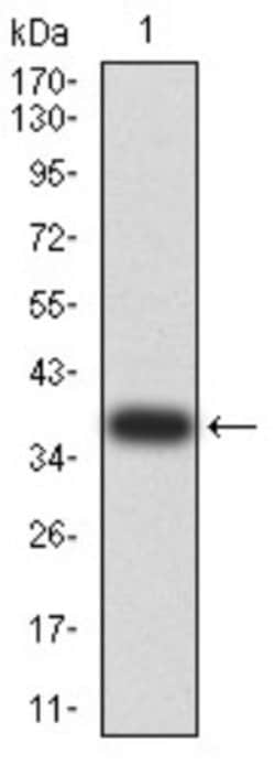 KLF2 Antibody (2F12A11) - BSA Free, Novus Biologicals 0.1 mL | Buy Online | Novus Biologicals | Fisher Scientific