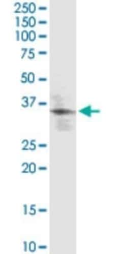 KLF2 Antibody (1D12), Novus Biologicals 0.1 mg | Buy Online | Novus Biologicals | Fisher Scientific