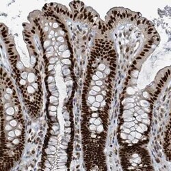 KLF3 Antibody, Novus Biologicals:Antibodies:Primary Antibodies