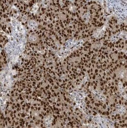 KLF3 Antibody, Novus Biologicals:Antibodies:Primary Antibodies