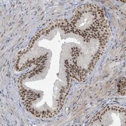 KLF3 Antibody, Novus Biologicals:Antibodies:Primary Antibodies