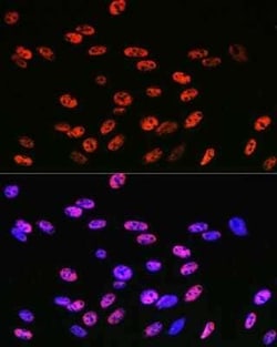 KLF4 Rabbit anti-Human, Mouse, Rat, Clone: 7B7U1, Novus Biologicals:Antibodies:Primary