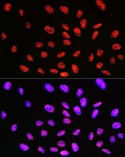 KLF4 Rabbit anti-Human, Mouse, Rat, Clone: 7B7U1, Novus Biologicals:Antibodies:Primary