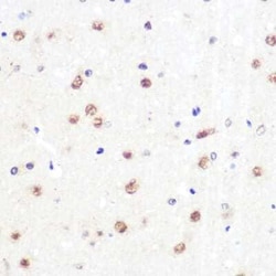 KLF4 Rabbit anti-Human, Mouse, Rat, Clone: 7B7U1, Novus Biologicals:Antibodies:Primary