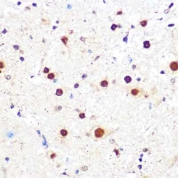 KLF4 Rabbit anti-Human, Mouse, Rat, Clone: 7B7U1, Novus Biologicals:Antibodies:Primary
