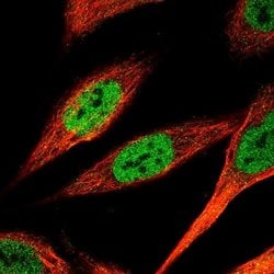 KLF4 Antibody (CL5782), Novus Biologicals:Antibodies:Primary Antibodies
