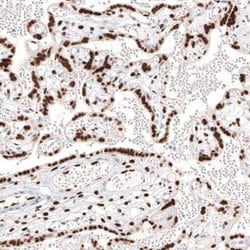 KLF4 Antibody (CL5782), Novus Biologicals:Antibodies:Primary Antibodies
