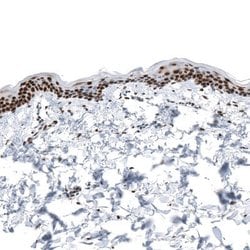 KLF4 Antibody (CL5785), Novus Biologicals:Antibodies:Primary Antibodies