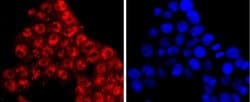 KLF4 Rabbit anti-Human, Clone: JF98-08, Novus Biologicals 100&mu;L:Antibodies,