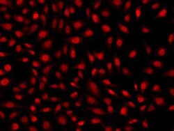 KLF6 Antibody, Novus Biologicals 100 &mu;g; Unconjugated:Antibodies, Polyclonal