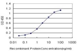 KLF9 Antibody (2B9), Novus Biologicals 0.1 mg | Buy Online | Novus Biologicals | Fisher Scientific