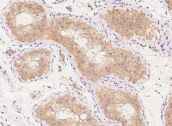 KLHL17 Antibody, Novus Biologicals:Antibodies:Primary Antibodies