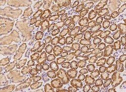 KLHL24 Antibody, Novus Biologicals:Antibodies:Primary Antibodies