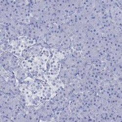 KLHL33 Rabbit anti-Human, Polyclonal, Novus Biologicals 100 &mu;g; Unconjugated:Antibodies,