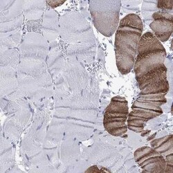 KLHL33 Rabbit anti-Human, Polyclonal, Novus Biologicals 100 &mu;g; Unconjugated:Antibodies,