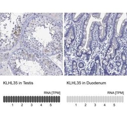 KLHL35 Rabbit anti-Human, Polyclonal, Novus Biologicals 100 &mu;g; Unconjugated:Antibodies,