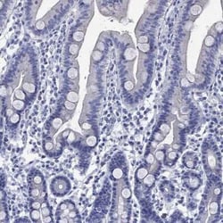KLHL35 Rabbit anti-Human, Polyclonal, Novus Biologicals 100 &mu;g; Unconjugated:Antibodies,