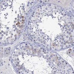 KLHL35 Rabbit anti-Human, Polyclonal, Novus Biologicals 100 &mu;g; Unconjugated:Antibodies,