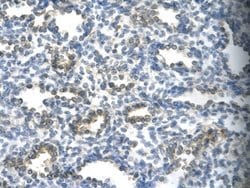 KMT1A/SUV39H1 Rabbit anti-Human, Polyclonal, Novus Biologicals 0.1ml; Unconjugated:Antibodies,