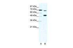 KMT2B Rabbit anti-Human, Polyclonal, Novus Biologicals 0.1ml; Unconjugated:Antibodies,